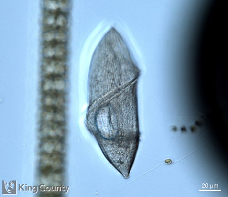 Photo of Gyrodinium spirale